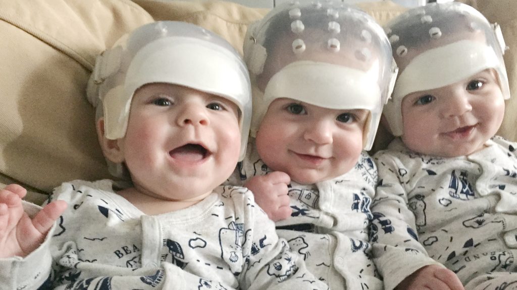They’re the rarest triplets in the world See what they look like today